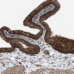 MYO18A Antibody, Novus Biologicals 0.1mL; Unlabeled:Antibodies, Polyclonal